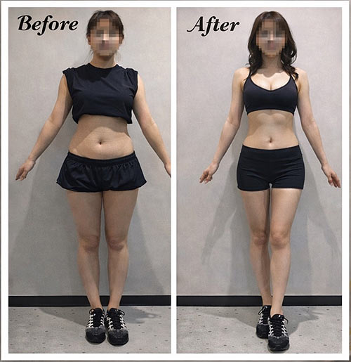 30代女性のBefore・After